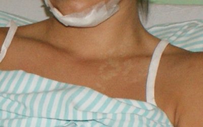 'Não achei que teria psicopata lá', diz pai de agredida em formatura em MS