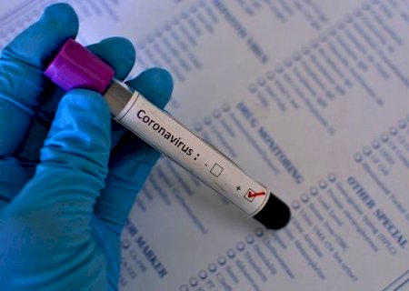 DEODÁPOLIS: Município tem o primeiro caso confirmado de Coronavírus