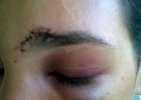 Mulher é agredida a socos e puxões de cabelo na frente de filho de 4 anos após de cobrar pensão