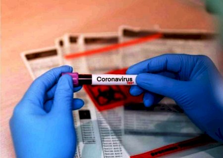 DEODÁPOLIS: Homem é o sexto caso confirmado de coronavírus