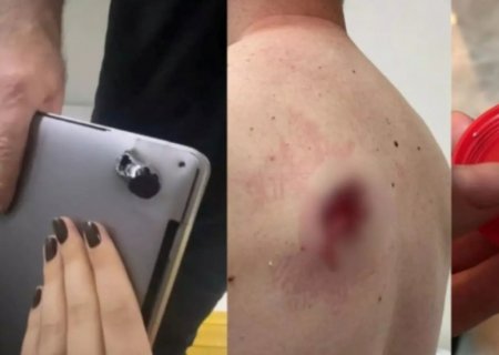 Homem é ‘salvo’ por notebook ao ser baleado durante assalto em São Paulo