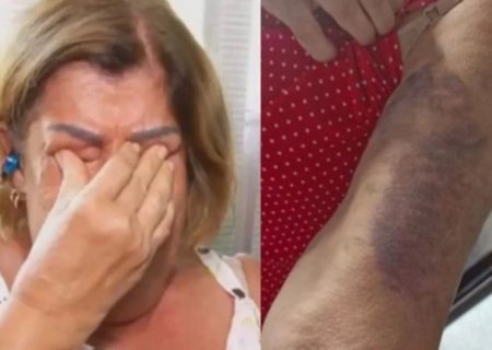 Professora espancada ao cobrar dever de casa está traumatizada: 'Medo'